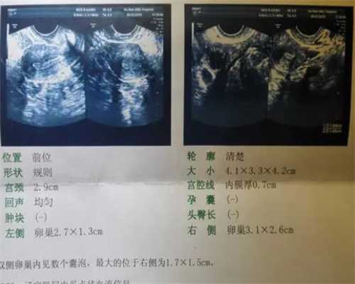 <b>重庆职业助孕网招聘,2023年小</b>