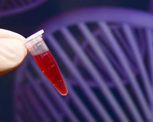 肩难产怎么处理,怎么样预防肩难产的发生