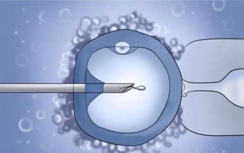 重庆同志代孕费用,重庆做试管婴儿，高龄该如何正确备孕？