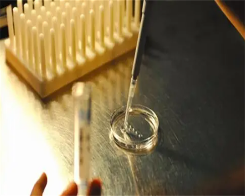 重庆私人医院供卵,去美国做试管婴儿前要吃叶酸吗？_南京哪家医院可以做供卵