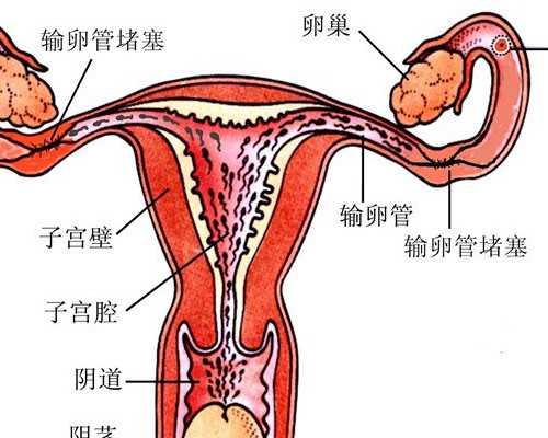 不孕不育科普之输卵管因素