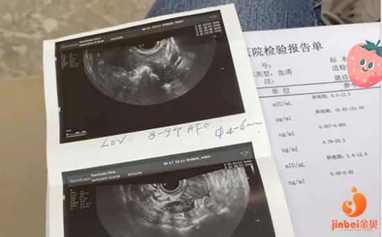 重庆重庆买卵_重庆捐卵官网_亲身经历告诉你试管婴儿过程痛苦吗？苦中有乐！