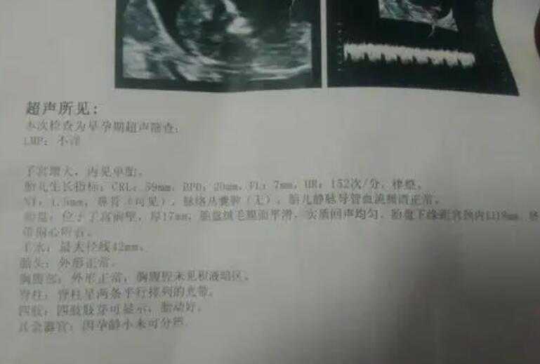 重庆供卵代怀专业吗 重庆市妇幼保健院试管婴儿费用明细-2022最新上半年数据费